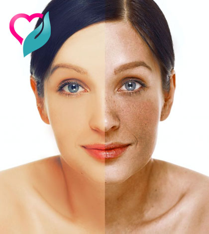 castor oil removes acne scars