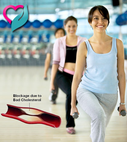 women exercising to reduce cholestrol