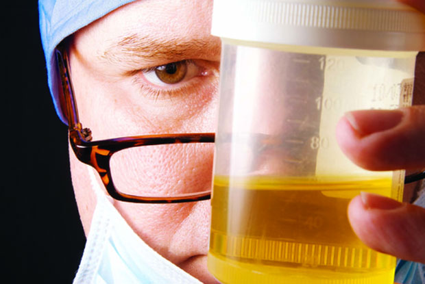 doctor checking the urine