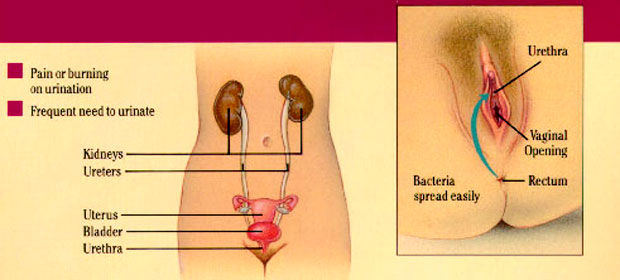 Pain During Sex