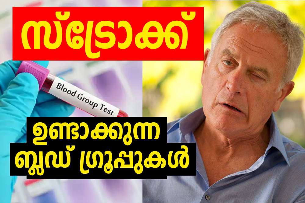 stroke creating blood groups