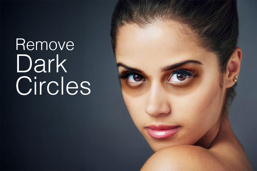 dark circles under eyes